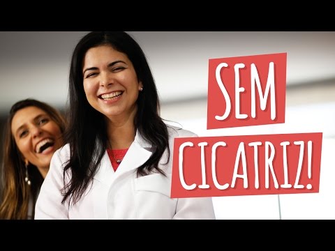 Vídeo: Como Se Livrar De Cicatrizes Nas Pernas