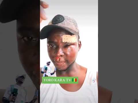 tentative d'assassinat contre yoro kara #abonnetoi #baatudeggtv #senegal  #shortvideo #viral