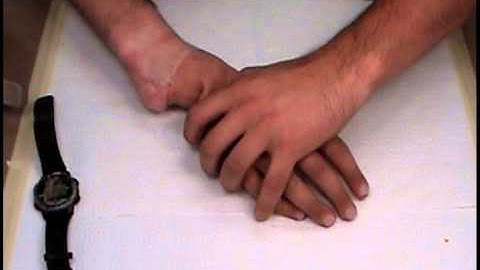 Custom Partial Hand - Right