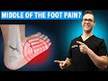 علاج إصابة Lisfranc ووقت التعافي [علاج آلام القدم الوسطى!]
