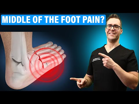 Lisfranc Injury Treatment u0026 Recovery Time [Middle Foot Pain CURE!]