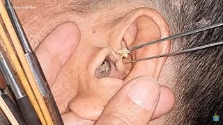 I love getting earwax at the barber shop