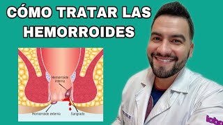 Que Son Las Hemorroides Y Como Tratarlas Hemorroides Dr David Campos