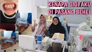 Akhirnya Pasang Behel