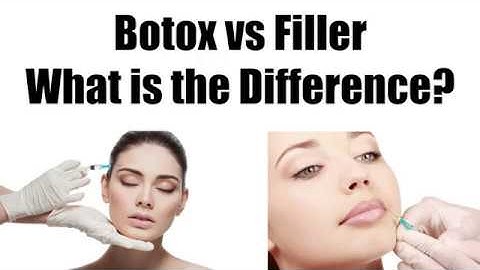 WHAT IS THE DIFFERENCE BETWEEN BOTOX AND FILLER?
