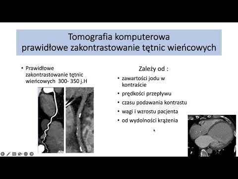 Wideo: Co to jest reimplantacja tętnic wieńcowych?