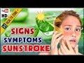 7 Signs of Sunstroke