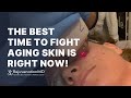 Proactive Skincare Tips for Your 30s