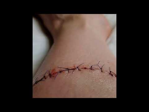 VTSS — VTSS - Fruition [SKIN001]
