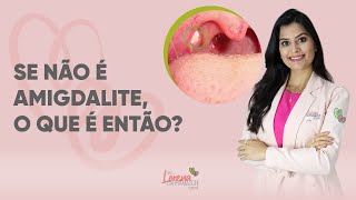 O que é um ponto branco na garganta da criança?