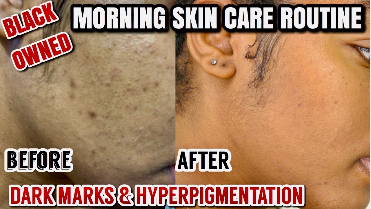 MORNING SKINCARE ROUTINE |CLEARING HYPERPIGMENTATION, DARK MARKS & ACNE |BLACK OWNED |GOLDENCHILDCHI
