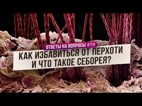 Перхоть: как победить и как предотвратить (Ответы на Вопросы)