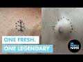One Fresh Back Cyst and One YouTube Legend | Dr. Pimple Popper