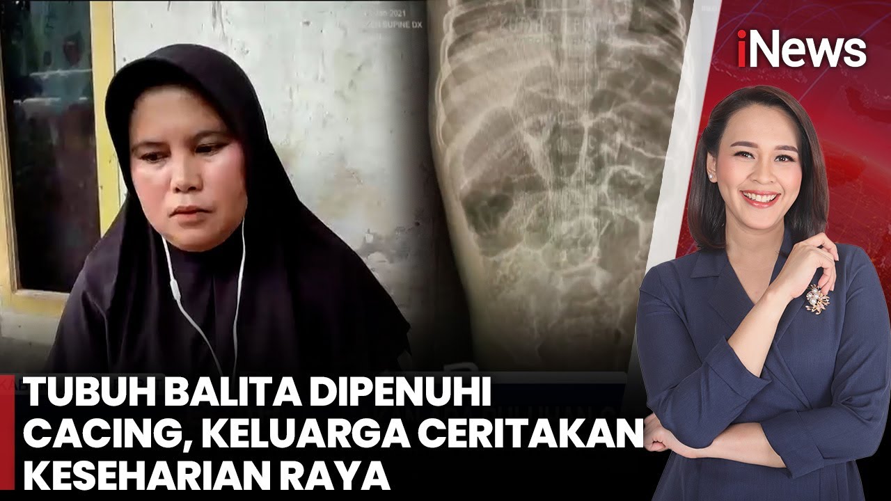 Sedih! Tubuh Balita 4 Tahun Dipenuhi Cacing, Keluarga Cerita Kehidupan Sehari-hari | iNews Siang