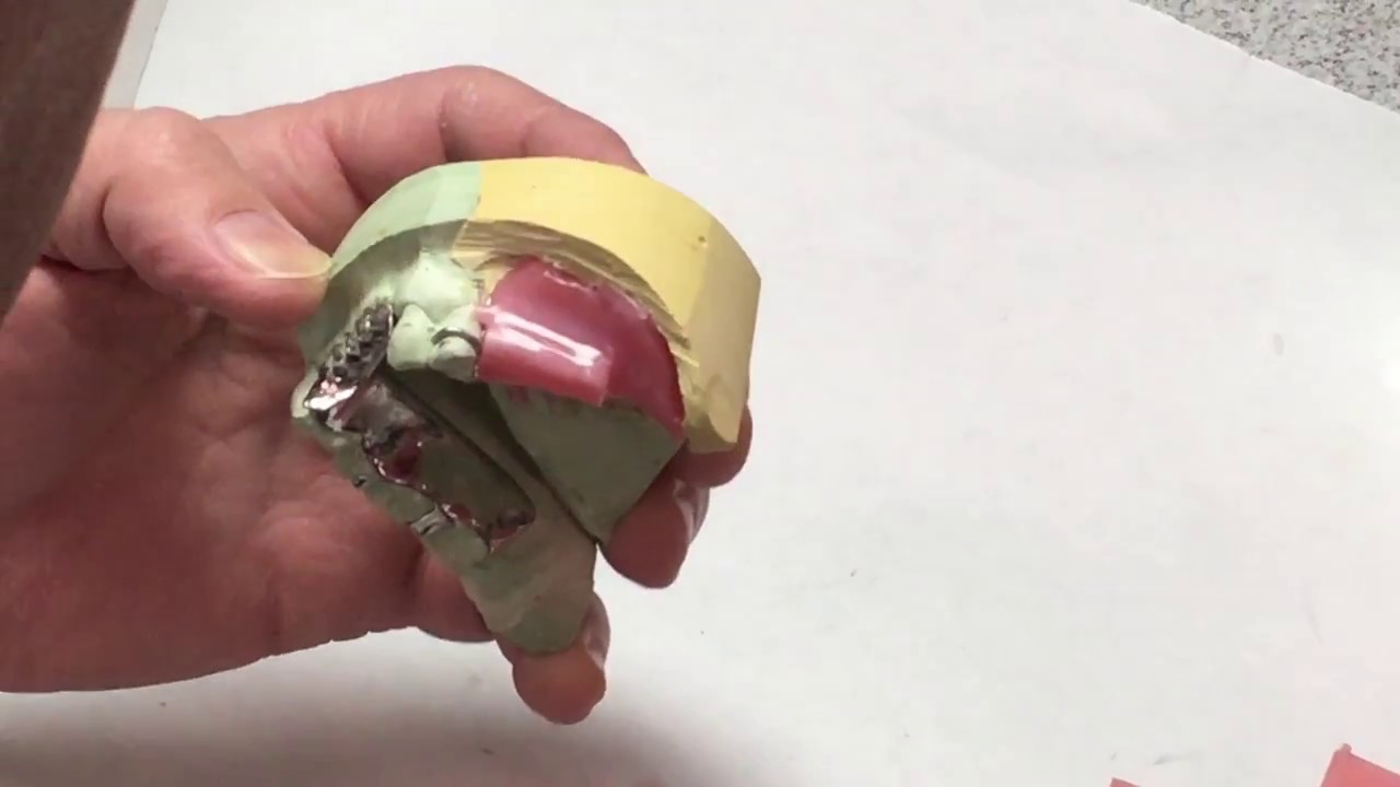 Bite Block video - YouTube