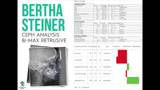 Bertha $20 Steiner Ceph Analysis