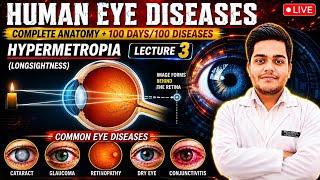 Hypermetropia | Longsightness| Lecture 3 | Ocular Diseases | PD Academy Medical |