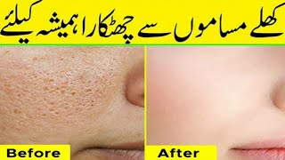 How To Get Rid Of Large Poresget Tigher & Smooth Skin Naturallyshrink Pores Fasthindi Urdu.