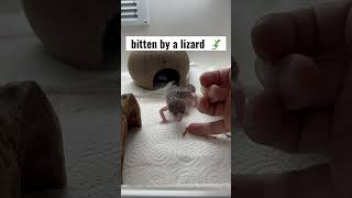 Don’t wiggle jiggle your finger before a lizard 🦎 got bitten by a lizard #shorts
