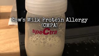 Cow Milk Protein Intolerance (CMPA) and Breastfeeding