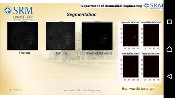 DETECTION OF EXUDATES IN FUNDUS IMAGES