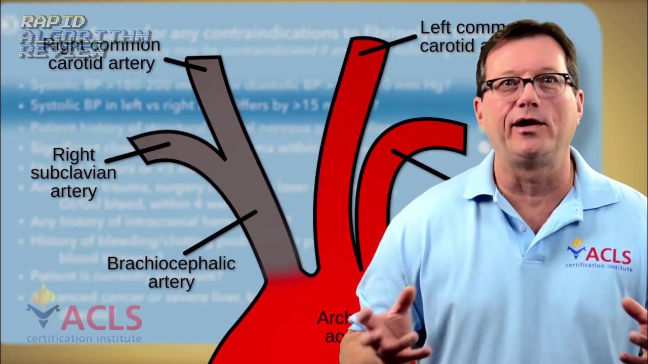 Emergency Fibrinolysis The Critical Time Saving Checklist - mpwdks3