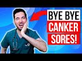 How to get rid of canker sores inside your mouth fast and treatment