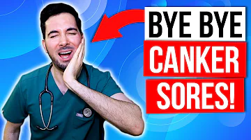 How to get rid of canker sores inside your mouth fast and treatment