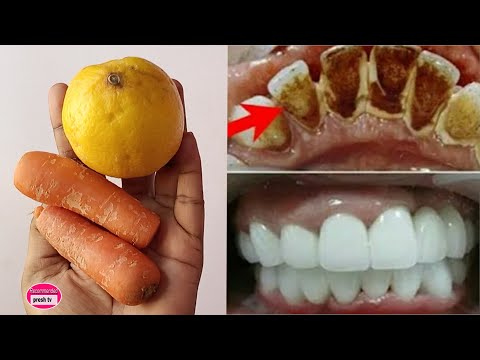 HOW TO WHITEN TEETH AT HOME NATURALLY IN 5 MINUTES! teeth whitening at home in 5 minutes! 100% WORKS