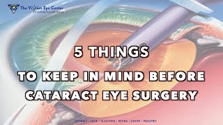 5 Tips before your CATARACT Eye Surgery - That you need to KNOW!!