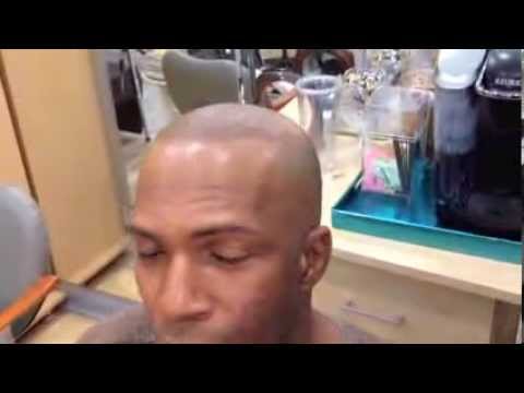 Video thumbnail: Scalp Micropigmentation | Scalp Pigmentation | Hair simulation- Mr A