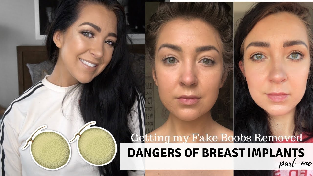 HOW MY FAKE BOOBS MADE ME SICK | Breast Explant Journey Pt. 1