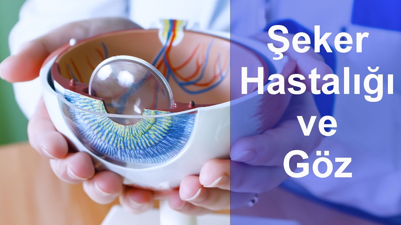 Şeker Hastalığının Göz (Retina) Üzerine Etkisi