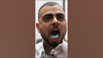 Test bite. #functionalanalysis #occlusion #dentaleducation