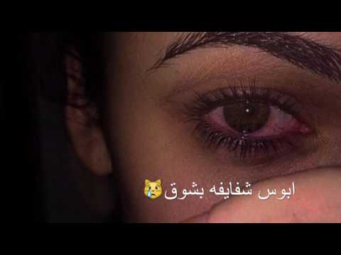 محمد جمال اذوني مسري مبطئ