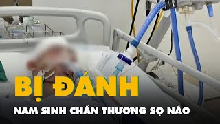 Một nam sinh lớp 8 bị người thân của bạn đánh chấn thương sọ não