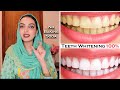 Teeth Whitening at Home 100% Easy Effective Tips for Sensitivity & Gums