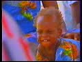1994 - Noma, pathologie oubliée... Ouma, Ismael, Ramata, et les autres (Images pouvant heurter)