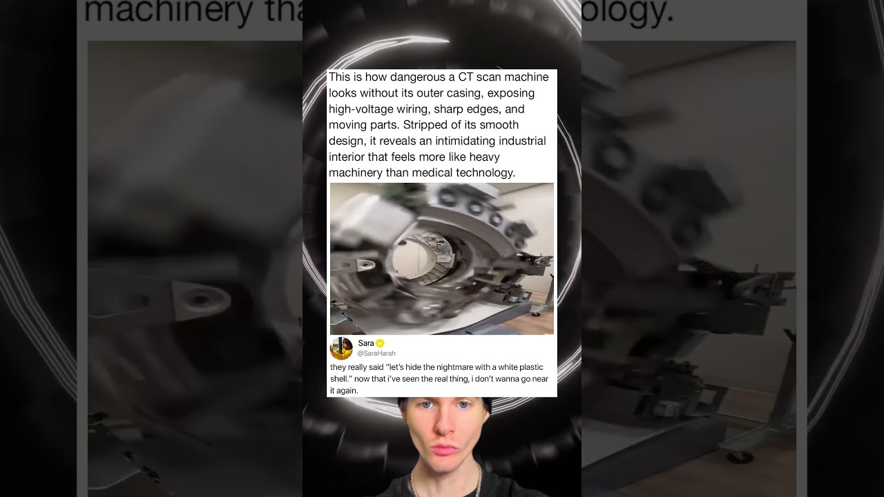 This is how dangerous a CT scan machine looks without its outer casing, exposing high-voltage