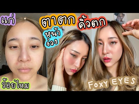 Vlog ทำสวย หน้าแก่กว่าวัย ตาไม่สดชื่น ตาตก คิ้วตก หน้าง่วง ขมับตอบ ร้อยไหม  foxy eye เป็นหมวย อินเตอ