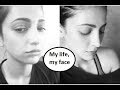 This is my life, my face, Shruti Haasan opens up about plastic surgery