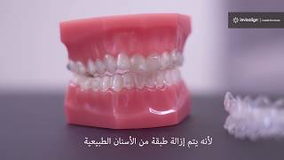 نظام Invisalign لتقويم الأسنان