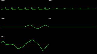 SECTOR 4 - PowerBlade // NES Oscilloscope view