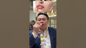 Nốt ruồi ở nhân trung tốt hay xấu ? phần 1 . #shorts