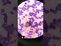 Giemsa Stained White Blood Cell Under The Microscope Laboratory Medtechstudent Mls Cls Blood 