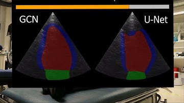 Towards Robust Cardiac Segmentation using Graph Convolutional Networks - Real Time Demo