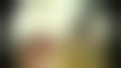 Frontal Trephining - Prof. P.J.Wormald