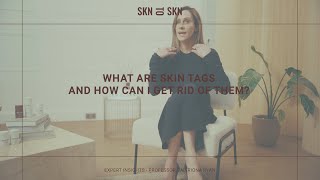 SKN TO SKN Expert Insight Series | Episode 2: What Are Skin Tags & How Can I Get Rid Of Them?