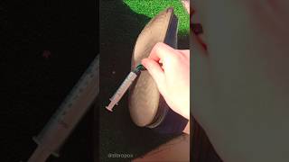 I Got A Needle Stuck In My Slippers At The Hospital. How Do I Get It Out?