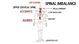 NECK & SHOULDER PAIN RELIEF | DOCTORS | SPECIALISTS | TREATMENTS | BOISE | MERIDIAN | EAGLE | IDAHO screenshot 1